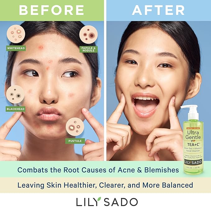LILY SADO TEA+C⢠Green Tea & Vitamin C Face Cleanser ā Natural Vegan Antioxidant Daily Face Wash with Aloe, Rosehip, Meadowfoam - Gentle Deep Cleansing for Acne, Blackheads, Blemishes. 8 oz