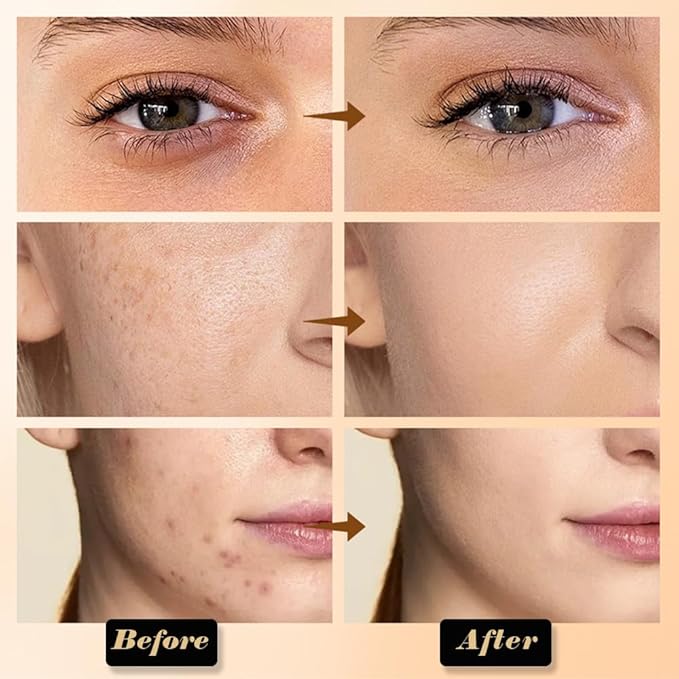 evpct 6 Colors Concealers Full Coverage Cream Contour Palette with Brush for Older Women, Under Eye Color Corrector Tri Color Pot Concealer Palette for Dark Circles Mature Skin Makeup, Waterproof, B2