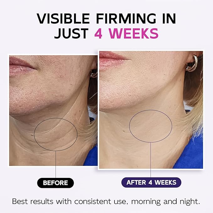 Firming Neck & Décolleté Cream with Retinol, AH-8 Hexapeptide, Collagen & Squalane – Instant Face Lift Cream for Wrinkles, Tightening & Crepey Skin – Neck Firming cream with Massage Roller – 4.3 fl oz