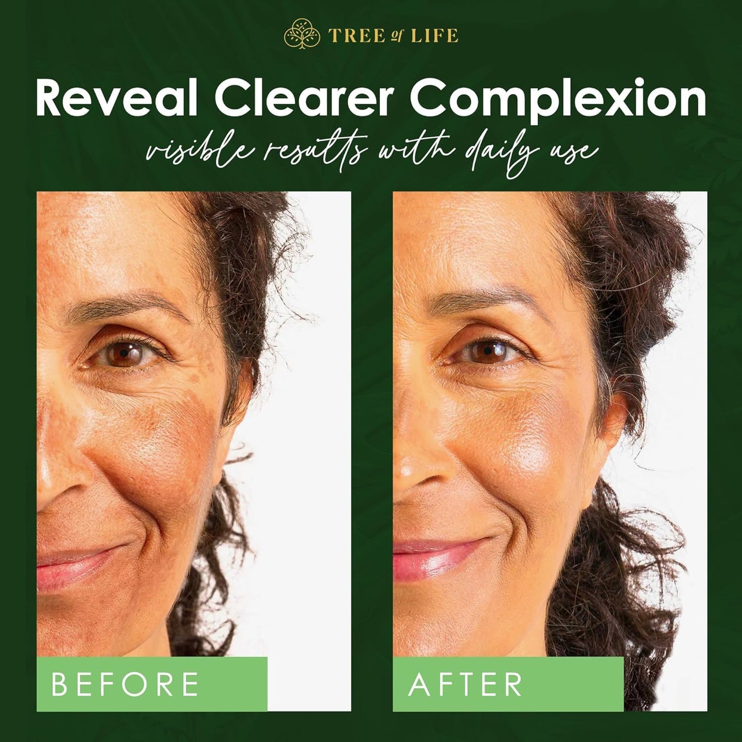 Tree of Life Beauty Niacinamide Vitamin B3 Serum, Hydrating Face Oil for Dark and Age Spots, Tightens Pores, Facial Serums for Sensitive Skin Care with Hyaluronic Acid and Vitamin E, 2 Fl Oz